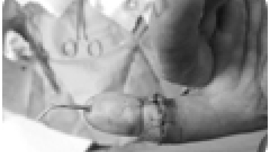 Reimplantes sucessivos em Gaia